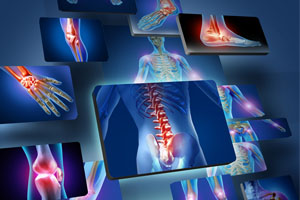 graphic of several windows displaying human anatomy images such as spinal chord, angle, knee, wrist.